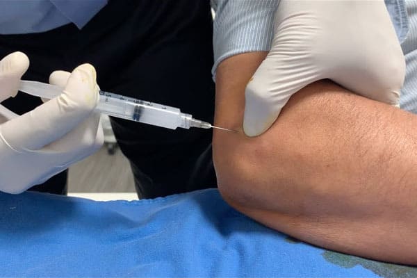 Tratamiento para la Epicondilitis