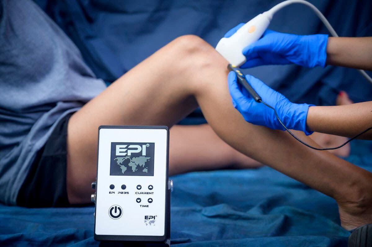 Fisioterapeuta en FisioSpace Génova, clínica de fisioterapia en Madrid, aplicando EPI (Electrólisis Percutánea Intratisular) para el tratamiento de lesiones tendinosas y regeneración de tejidos.