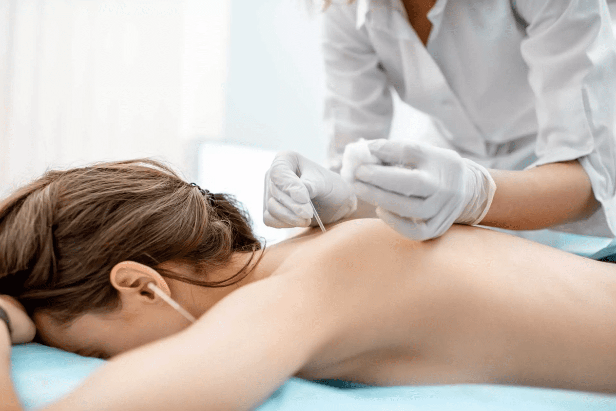 Fisioterapeuta en FisioSpace Génova, tu clínica de fisioterapia en Madrid, realizando tratamiento de punción seca para aliviar contracturas y puntos gatillo musculares.
