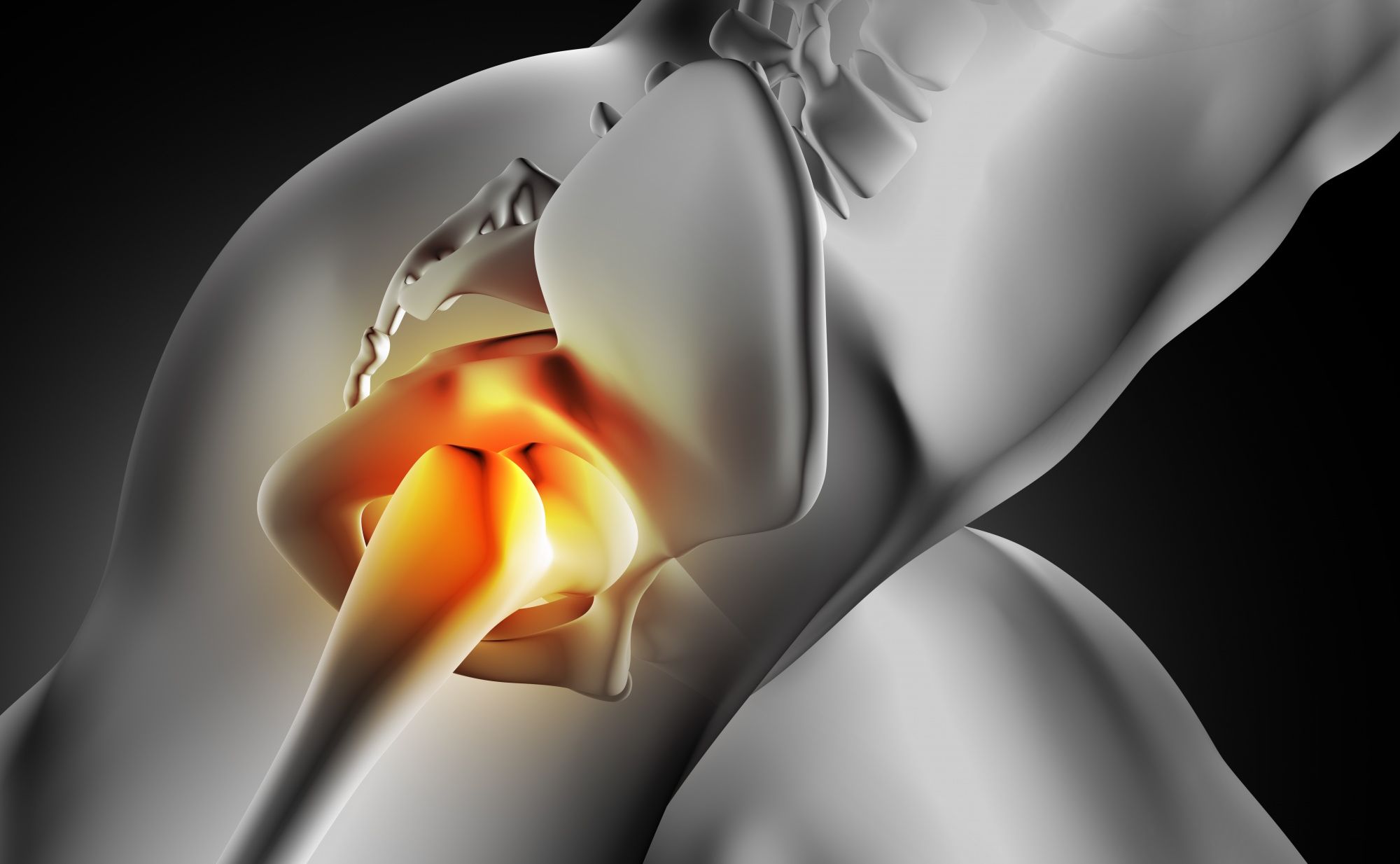 Imagen representativa del dolor en la cadera, una zona tratada con terapias avanzadas en nuestra clínica de fisioterapia en Madrid, FisioSpace Génova.