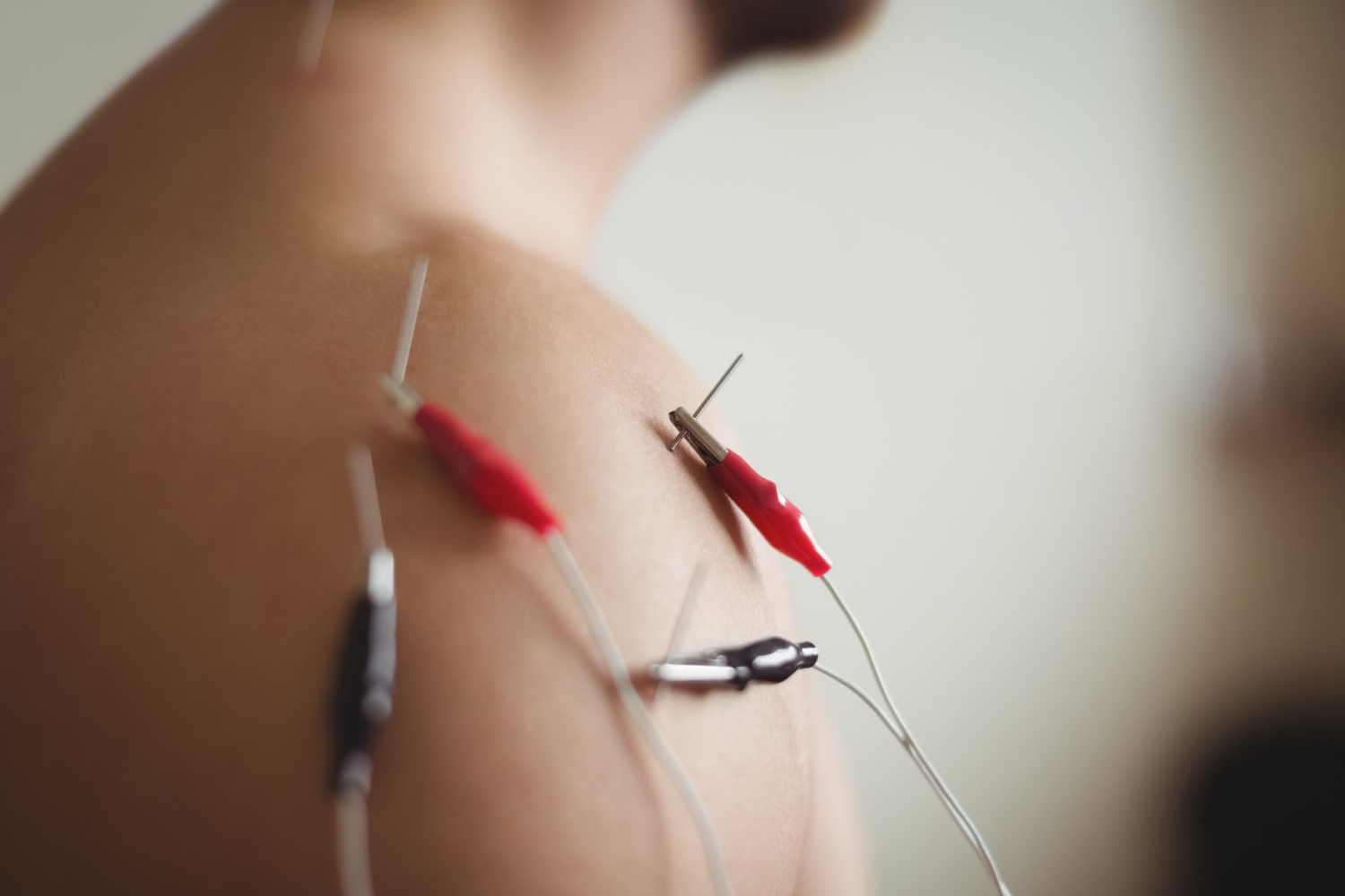 tratamiento artritis