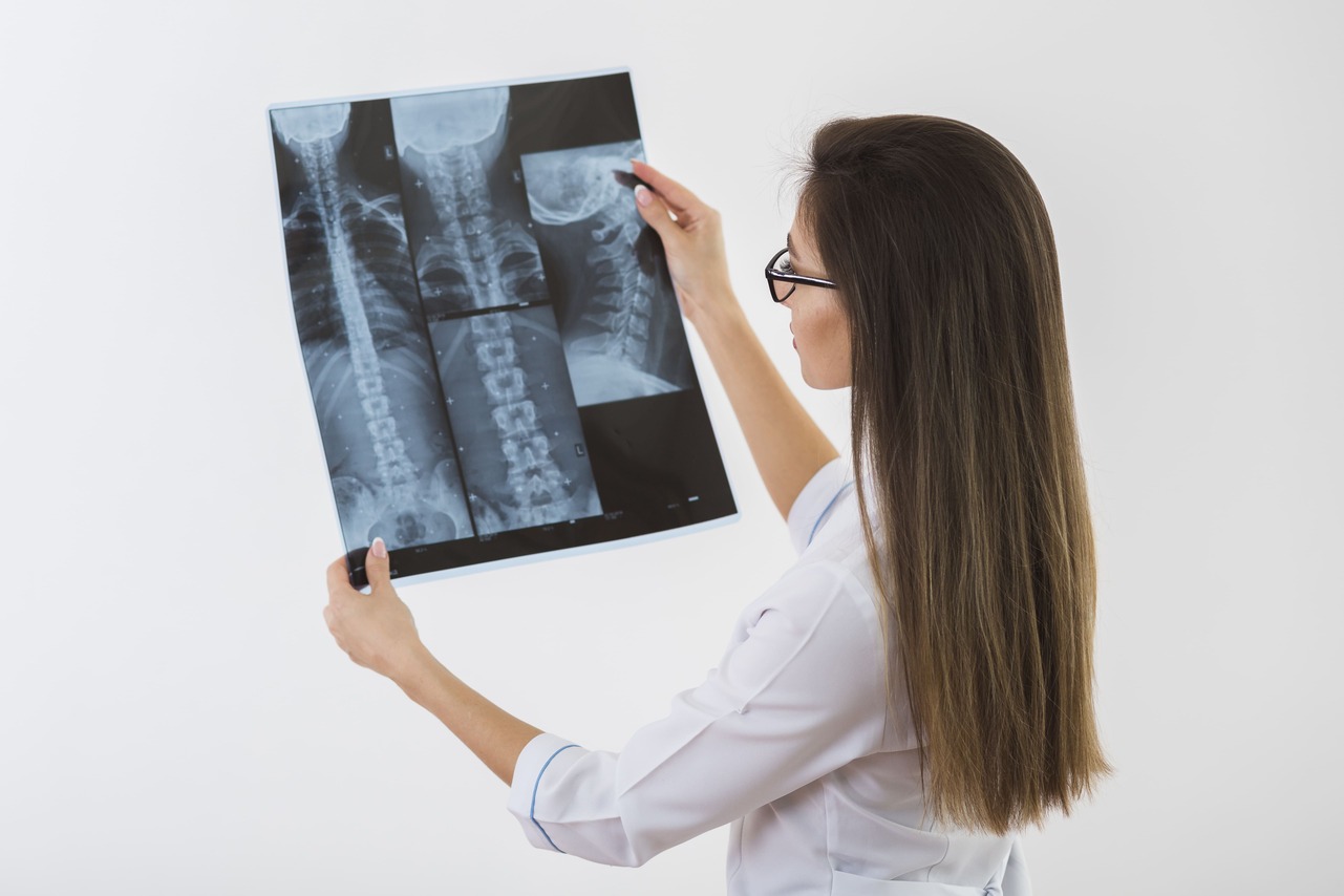 Médico especialista observando radiografía de columna vertebral para detectar signos de osteoporosis en paciente